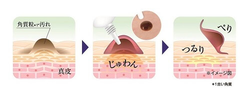 Kem Xoá Mụn Ruồi Tsubuporon Night Patch 20g Nhật Bản