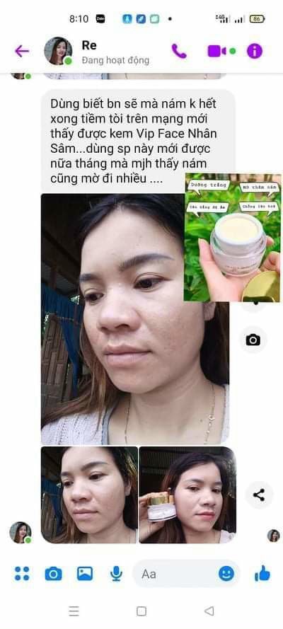 Kem VIP FACE NHÂN SÂM (MẪU MỚI PHIÊN BẢN 2021) giúp đánh bay nám tàn nhang trắng da ngừa lão hóa TẶNG BĂNG ĐÔ +GẤP TÓC