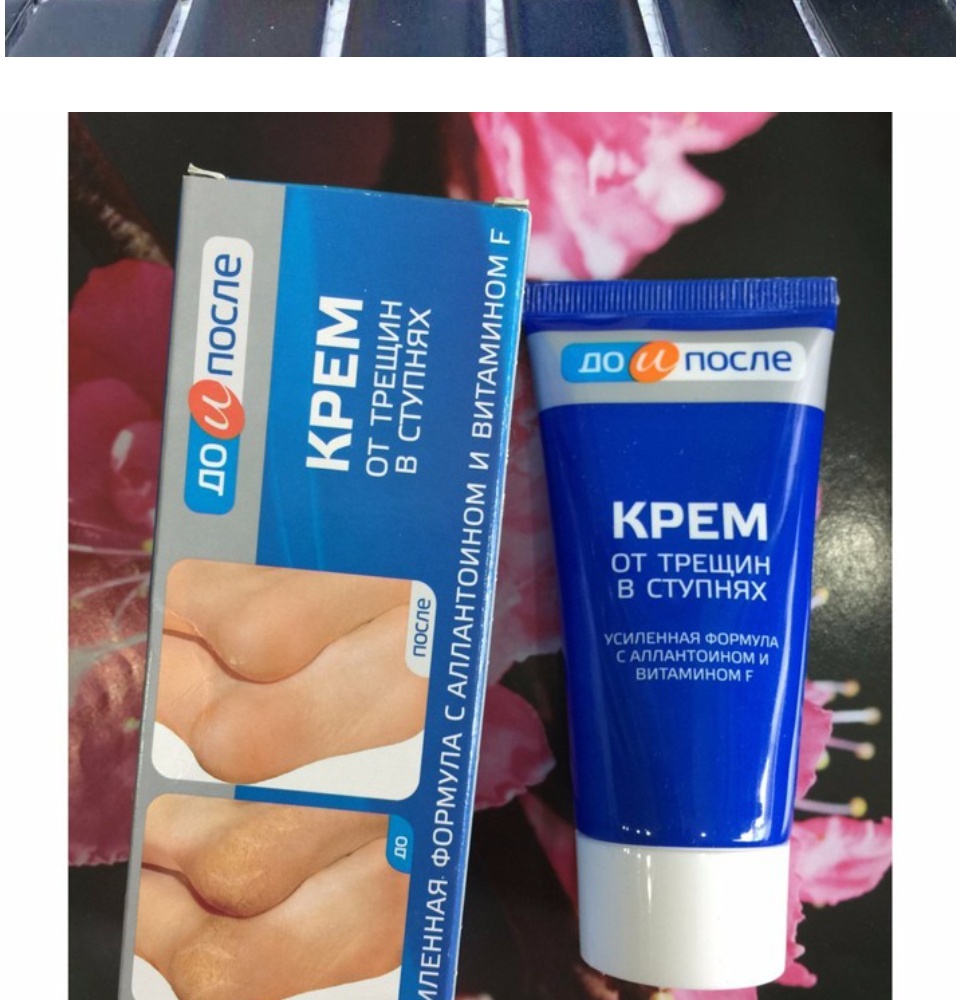 Kem mờ nứt gót chân Nga Kem làm liền vết nứt chân tay Kem dưỡng da làm mềm da 8