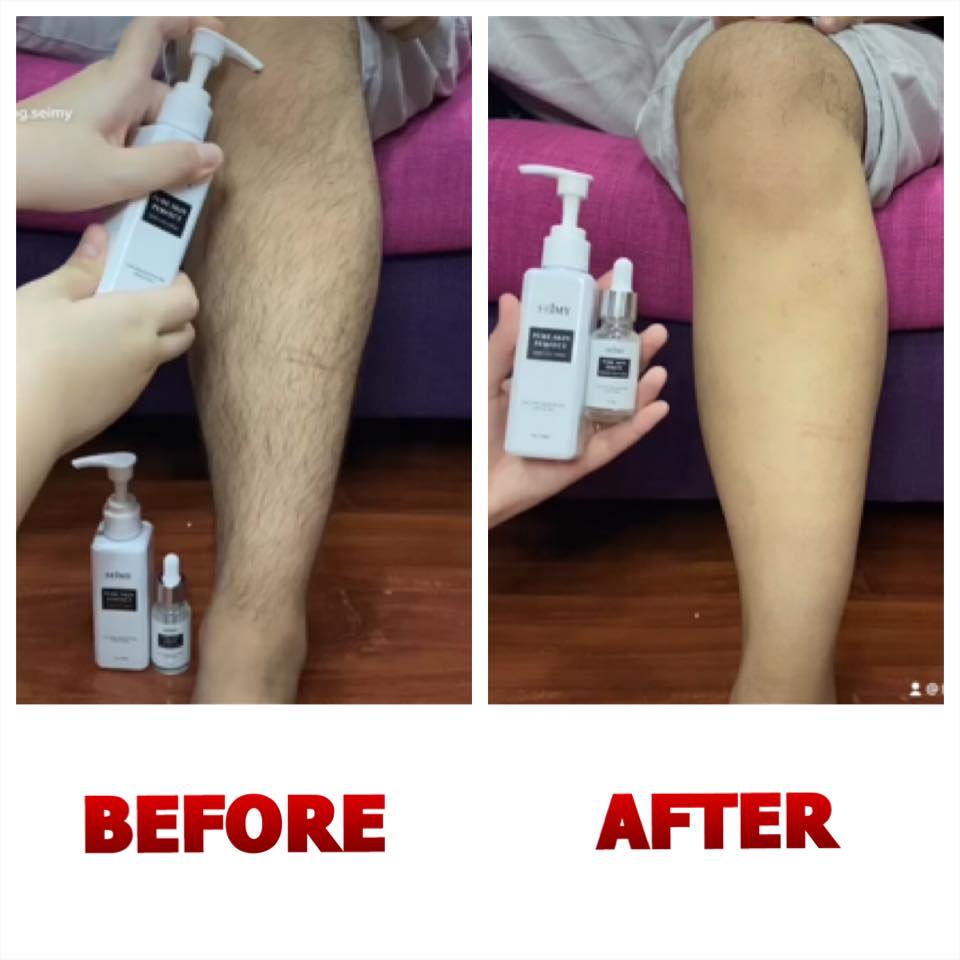 Combo Kem Tẩy Lông_ Seimy Pure Skin Perfect ( Gồm kem và serum dưỡng) Triệt Sạch Lông Chỉ Sau 5 Phút sử dụng